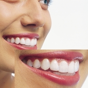 綺麗な歯並び