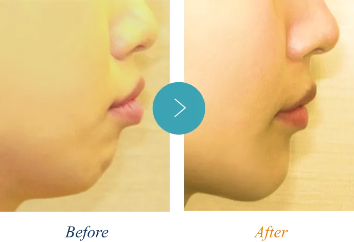 Eラインの症例1