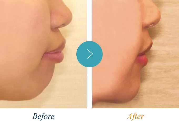 Eラインの症例2