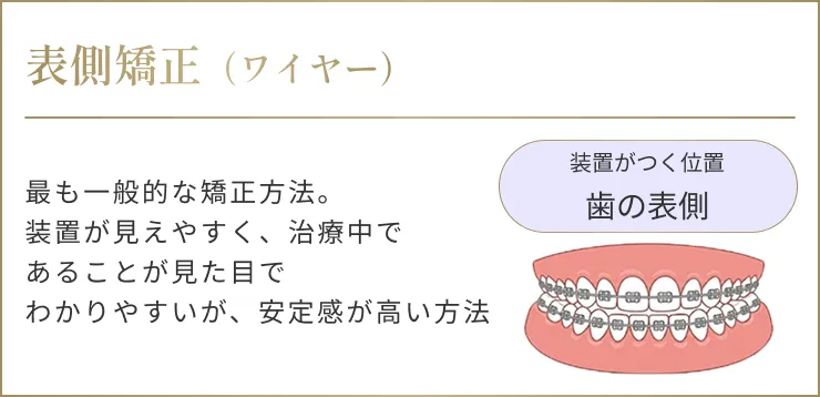 表側矯正（ワイヤー）