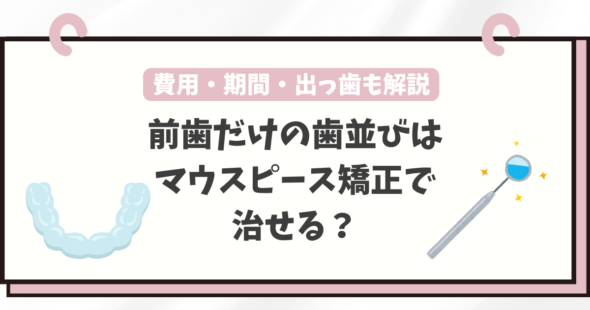 マウスピース矯正 前歯だけ